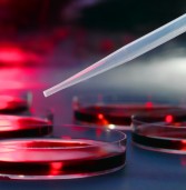 Trending Biotech Stocks on the Run  ArQule (ARQL), Sangamo Biosciences (SGMO), Synthetic Biologics (SYN), Advaxis, (ADXS), Idera Pharmaceuticals, (IDRA)