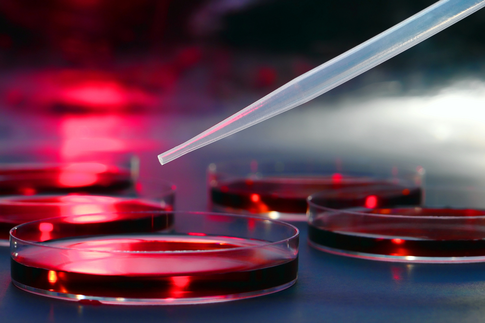 Trending Biotech Stocks on the Run – ArQule (ARQL), Sangamo Biosciences (SGMO), Synthetic Biologics (SYN), Advaxis, (ADXS), Idera Pharmaceuticals, (IDRA)